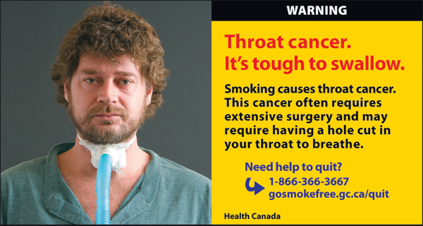 Canada 2012  Health Effects other - lived experience, throat cancer - cigars eng